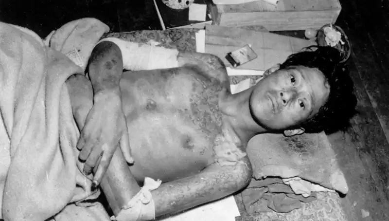 80 Yıl Sonra Nagasaki’den Dünyaya Çarpıcı Çağrı: Nükleer Tehditler Artıyor