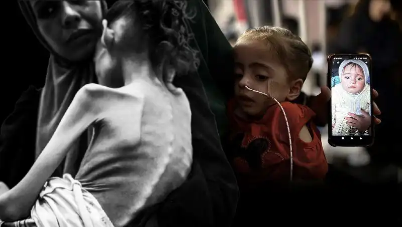 Küçük Meryem’in 10 Kilo Mucizesi: Açlıkla Verdiği Mücadele